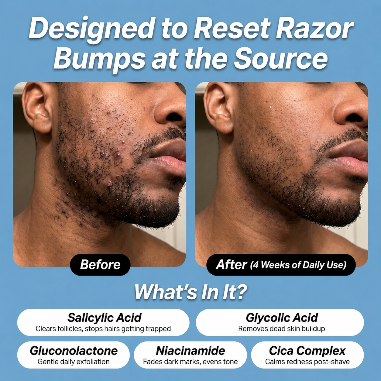 Okaro™ Bump Relief Soothing