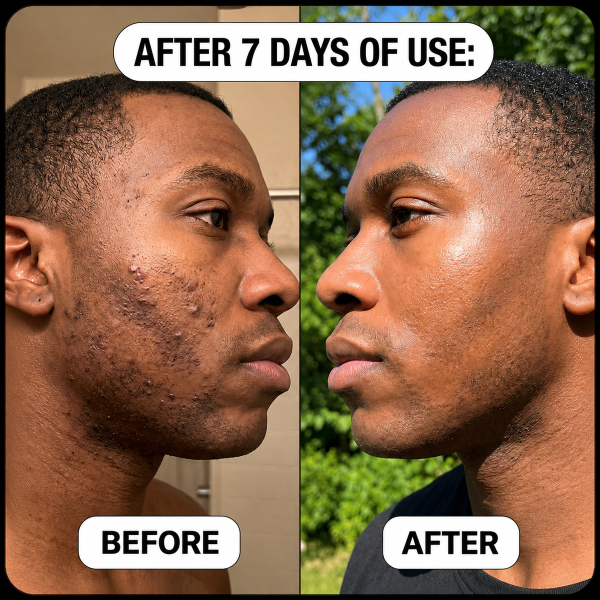 Okaro™ Bump Relief Soothing